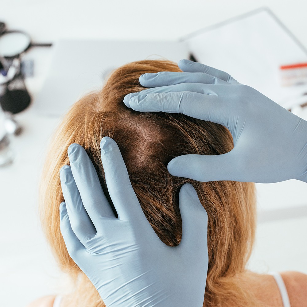 Dermatologist looking at woman's scalp